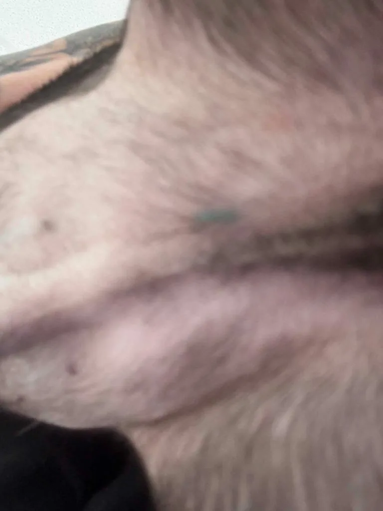 Miracle thumbnail 2