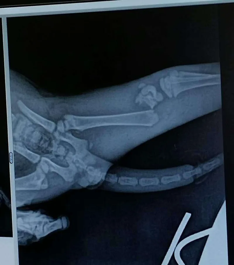 Miracle Ii thumbnail 4