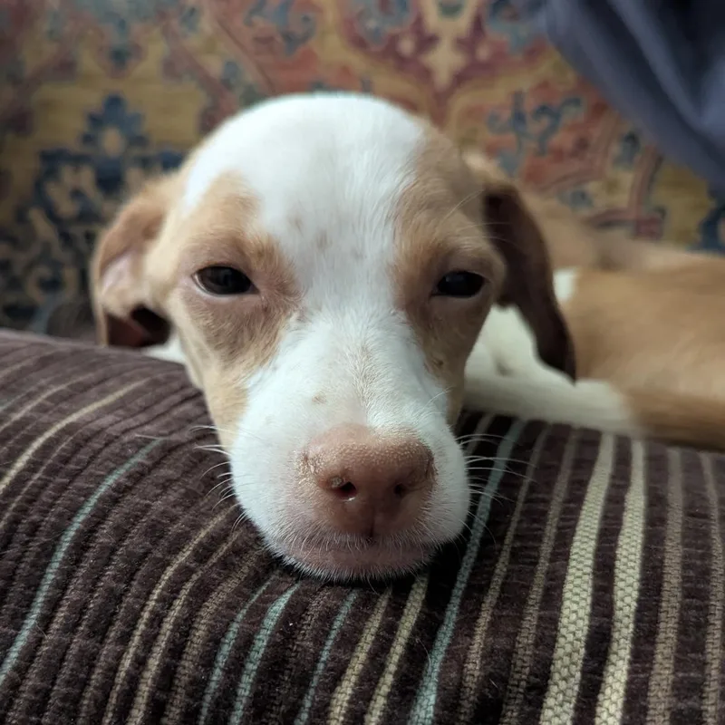 Clavicle thumbnail 5