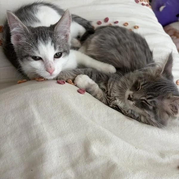 Hammertoe thumbnail 5