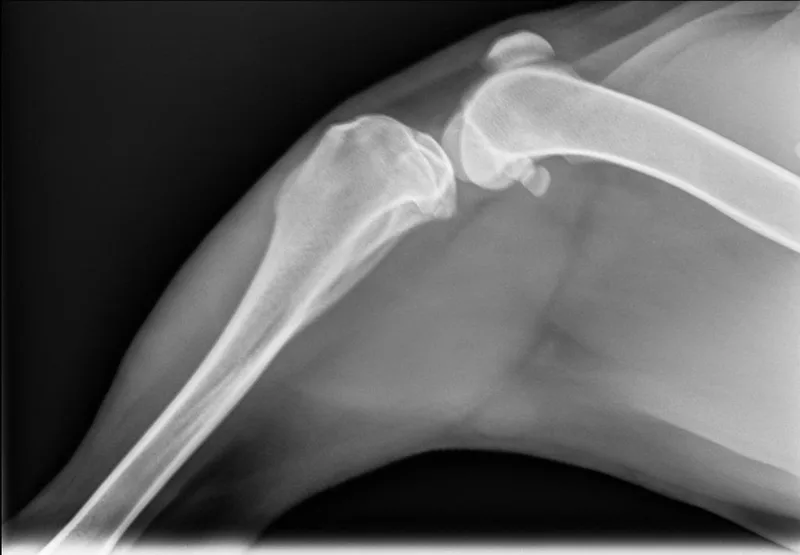 Scarlett thumbnail 4