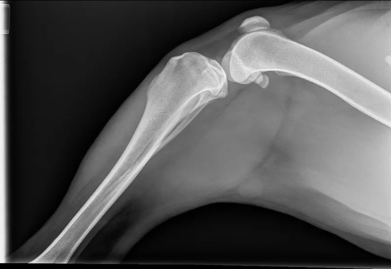 Scarlett thumbnail 6