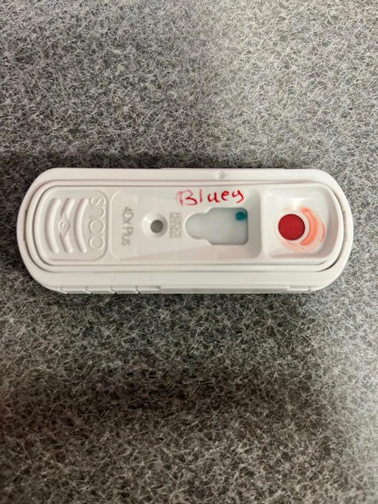 A young large-sized male Hound dog named Bluey for adoption in Hopkinsville, KY